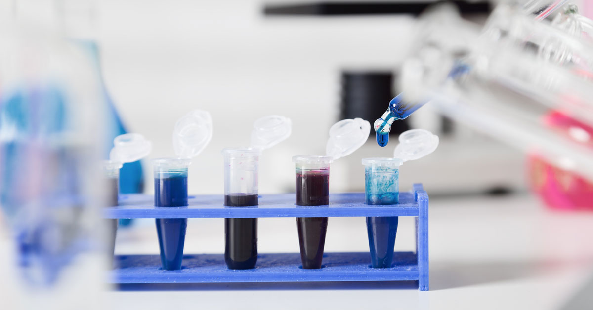 DNA samples are loaded plate for PCR analysis