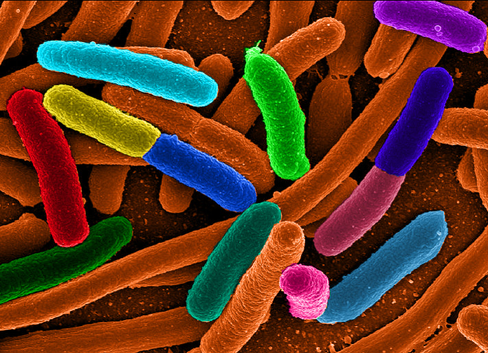 e. coli bacteria