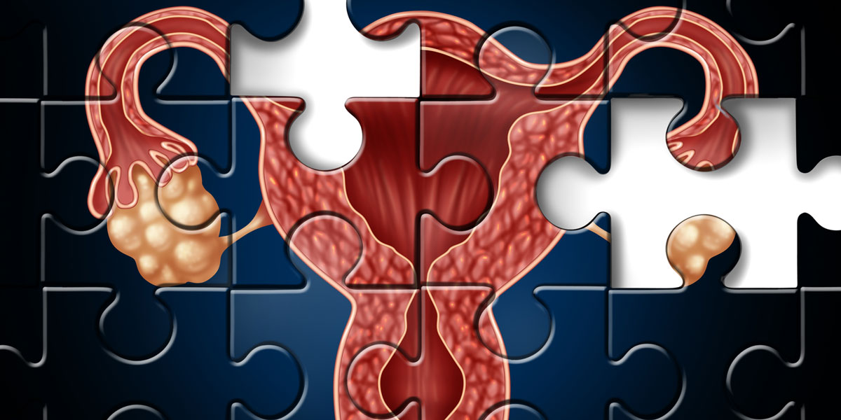 Fertility compromized puzzle pieces