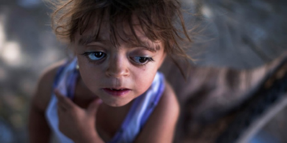 GMO Argentina glyphosate deformity
