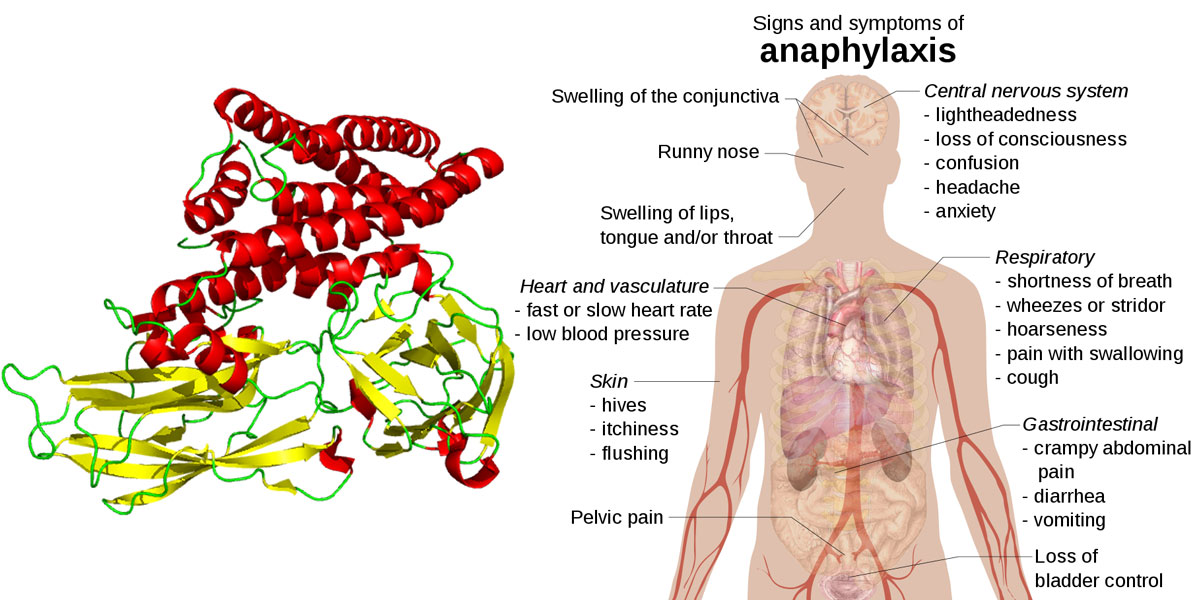 GM Bt toxin Cry1Ac and Signs and symptoms of anaphylaxis