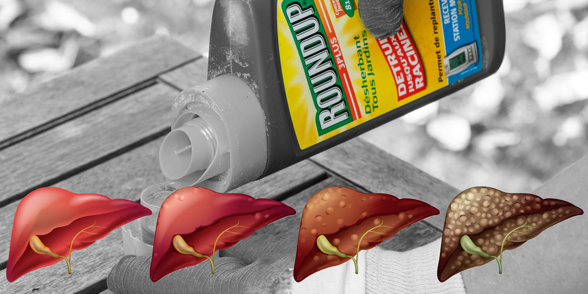 Monsanto Roundup Glyphosate and Liver disease