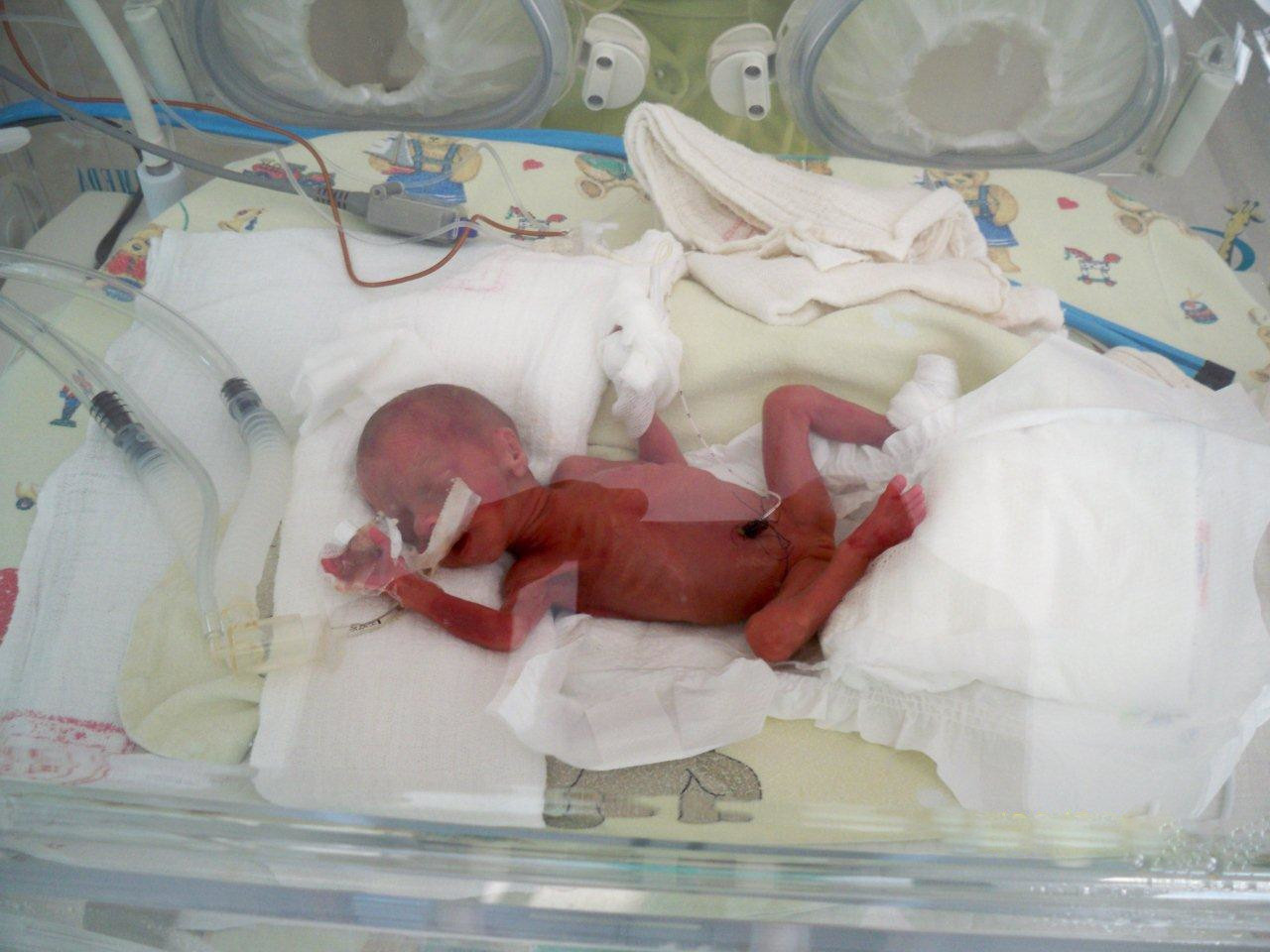 Nina Wcześniak baby in incubator.jpg