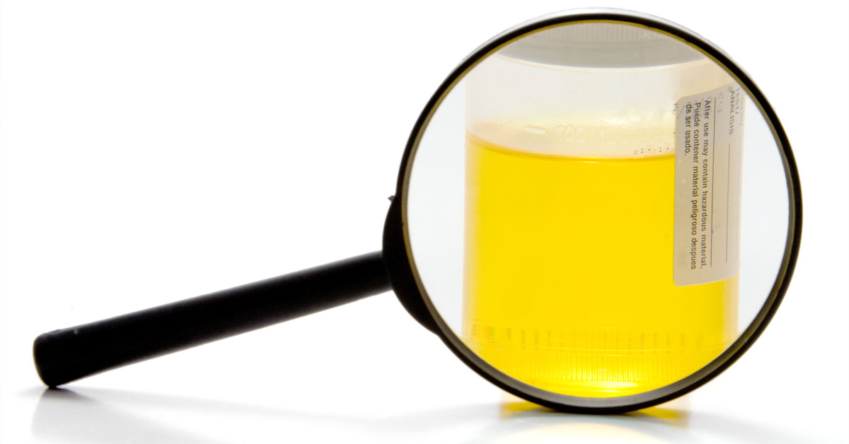 Urine sample and magnifying glass